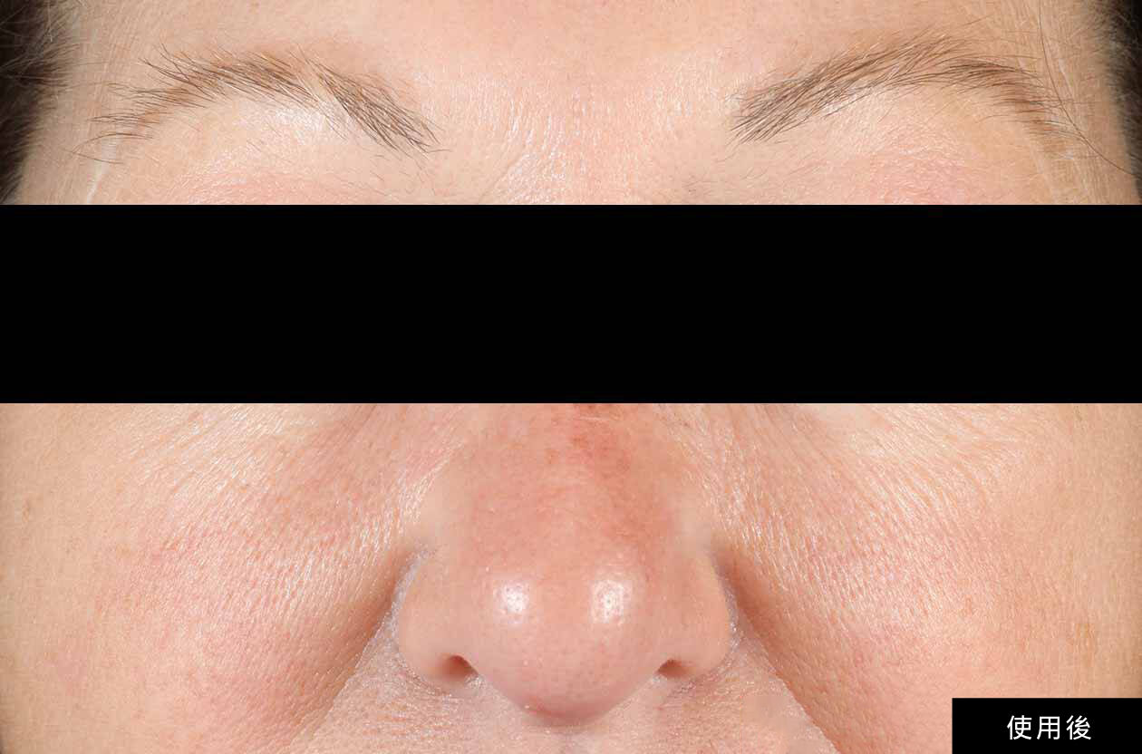 After Banner