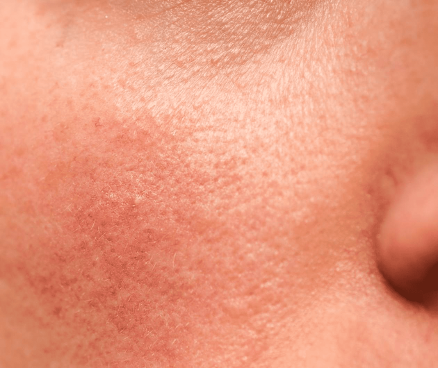 Protect Skin from Environmental Aggressors