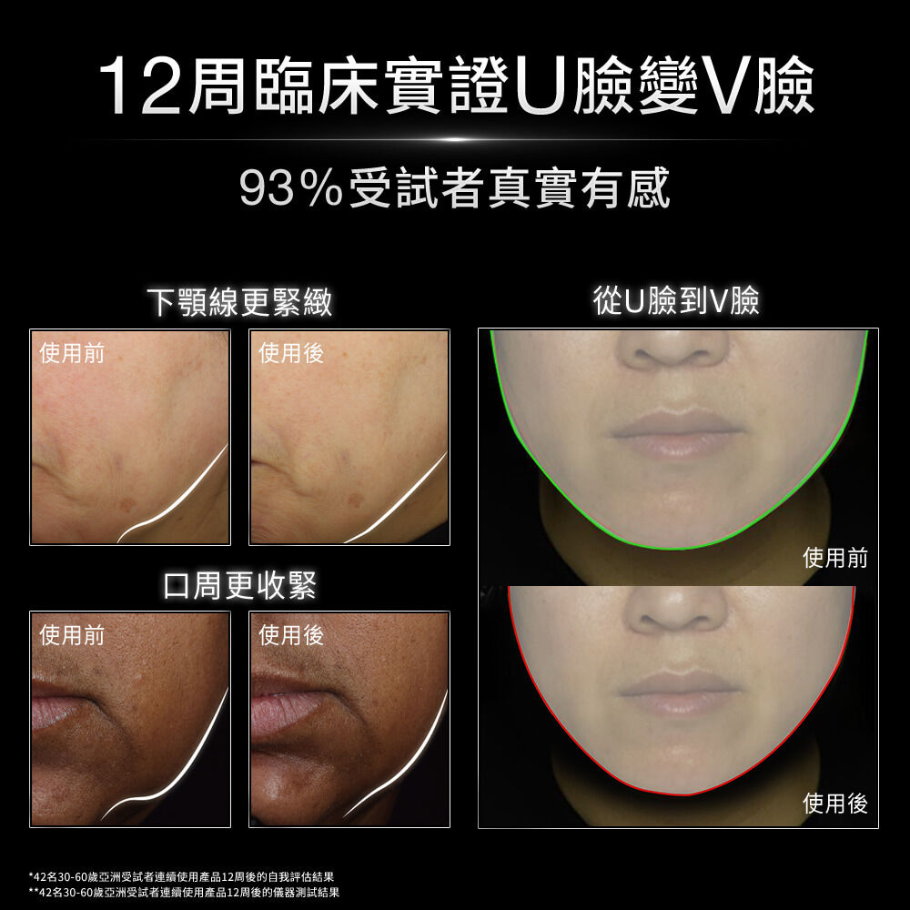 A.G.E.極效賦活緊緻精華