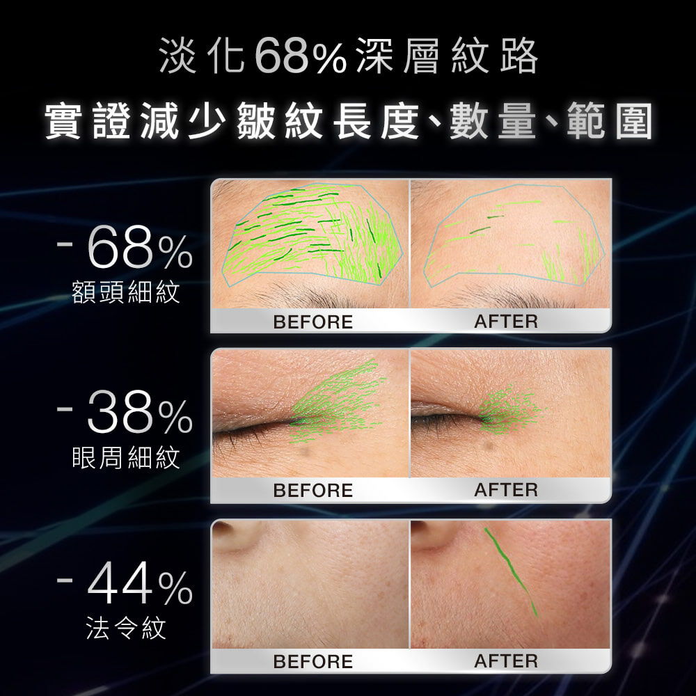 P-TIOX超胜肽抗皺極光精華