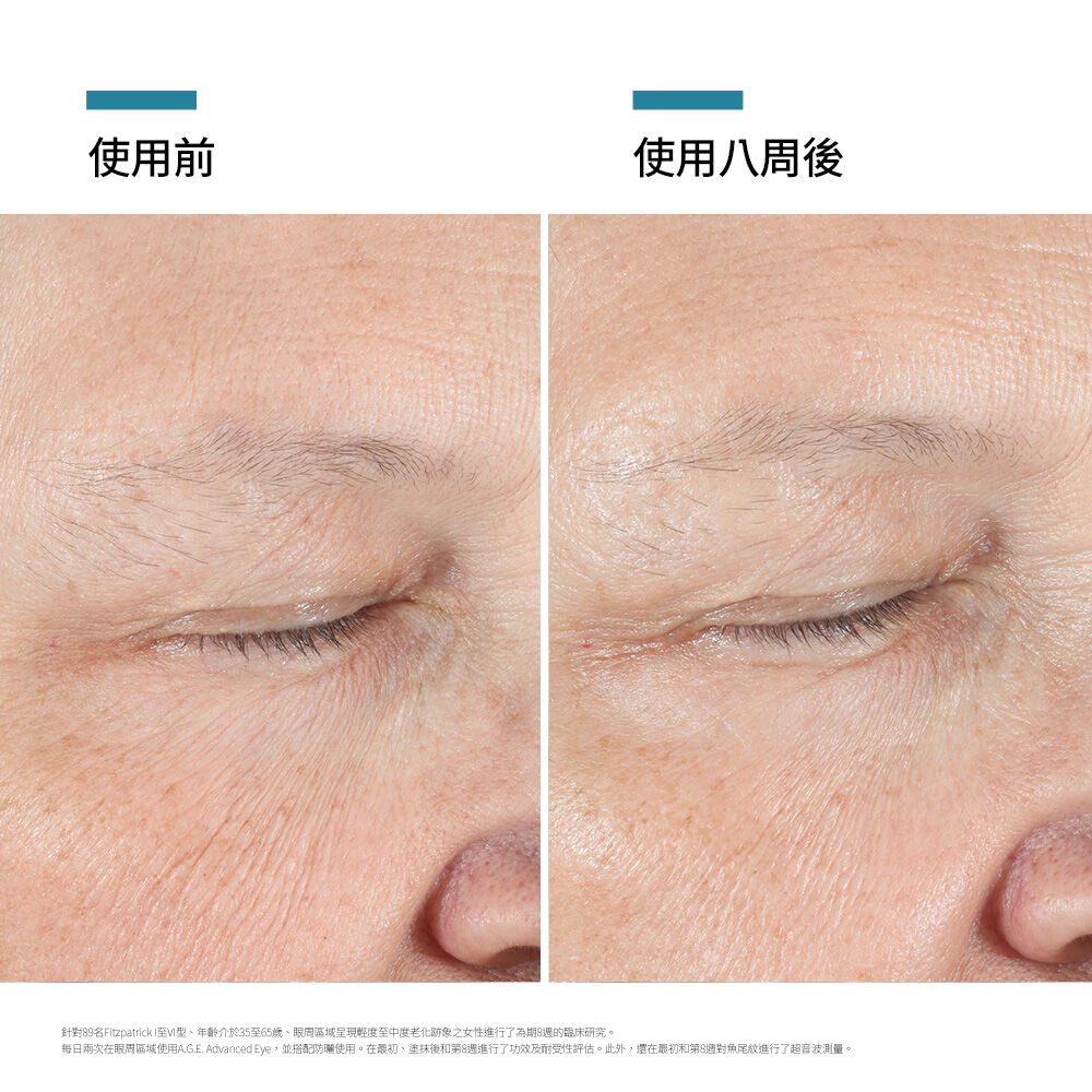 AGE普拉斯鏈彈潤緊緻眼霜